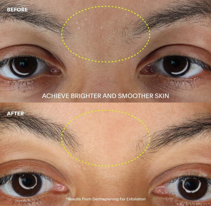 Close-up of mercury-colored dermaplaner blade with textured, stainless steel surface and beveled edge for precise