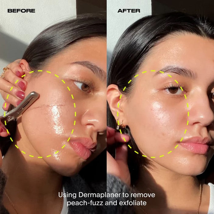 Close-up of the Rose Gold Leaf Face and Body Set Kit’s textured razor handle with engraved branding, showcasing intricate