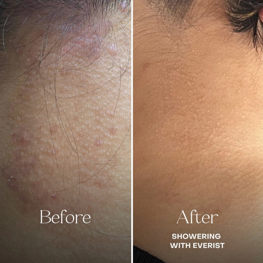 Close-up of the Everist Shampoo Concentrate Tin showcasing the minimalistic, fragrance-free label detail and brushed metal