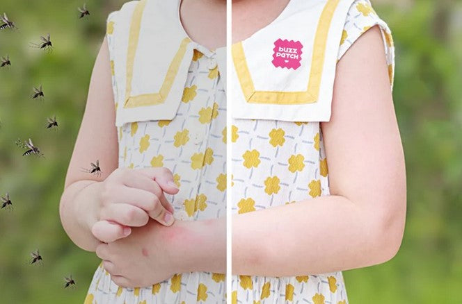 Child wearing mosquito repellent patch showing reduced mosquito bites compared to untreated skin natural DEET free protection