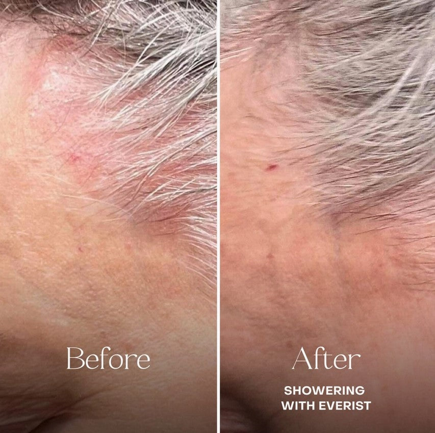 Close-up of Everist Conditioning Concentrate Tin showing fragrance-free label and matte metallic finish from a top-down angle