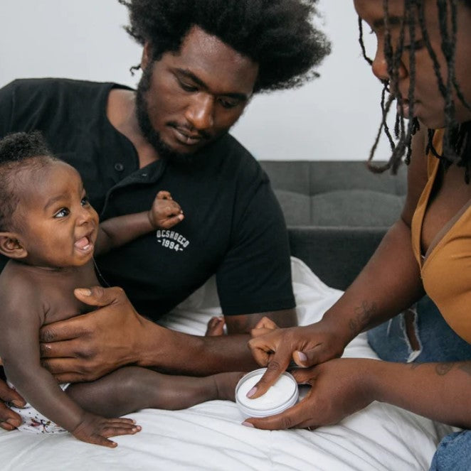 Close-up of Birch Baby Diaper Balm jar’s textured, soft herbal-scented formula with clear volume label in bright packaging